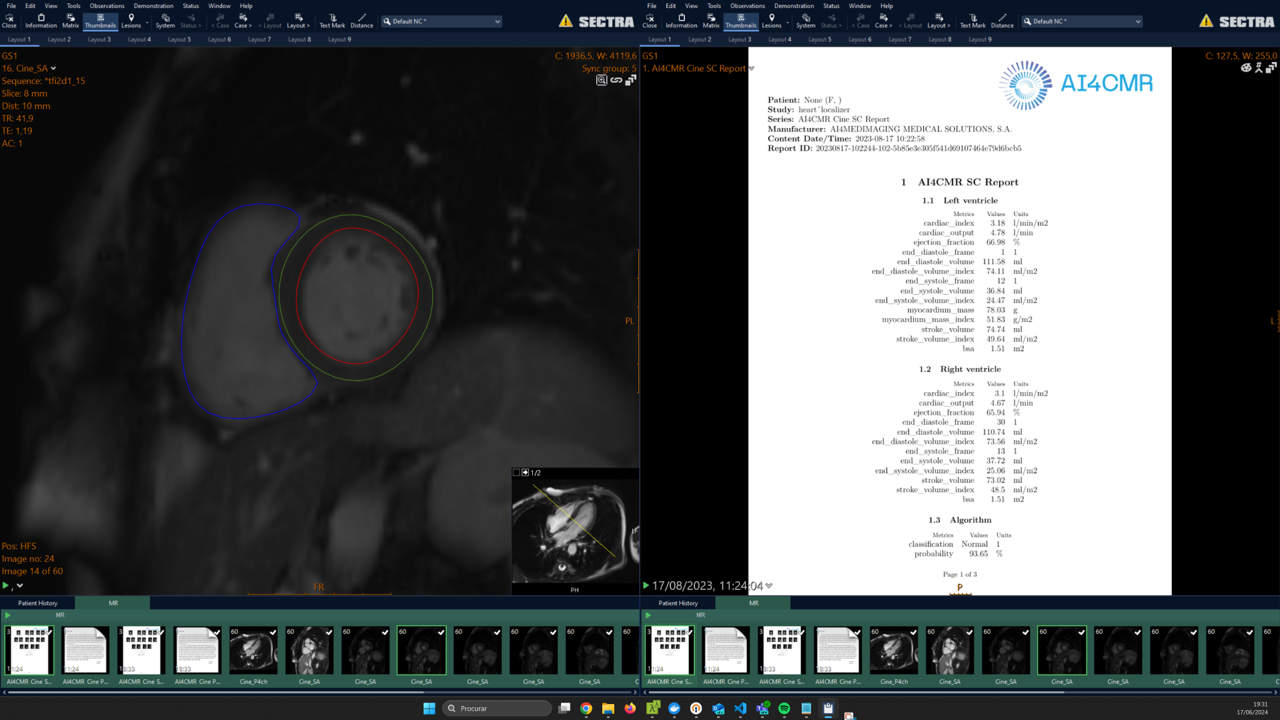 AI4CMR - Sectra Amplifier Marketplace