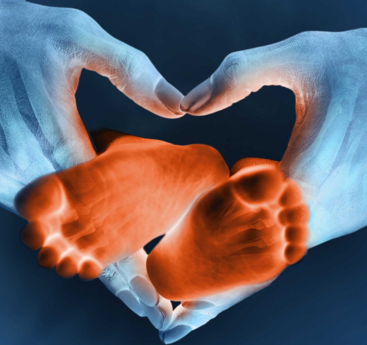 Sectra brand photo: children's feet within hands shaped as heart