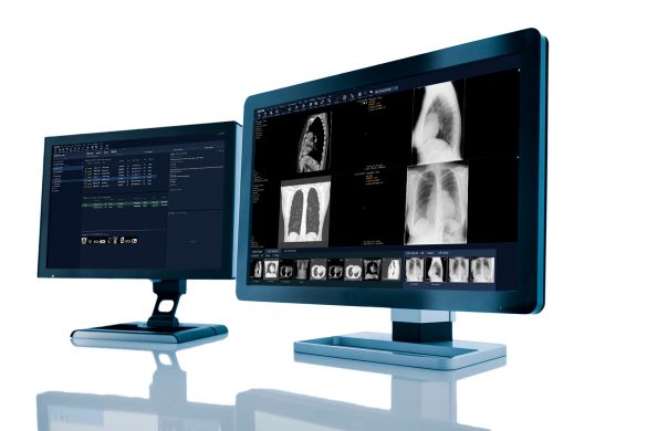 Sectra's radiology solution