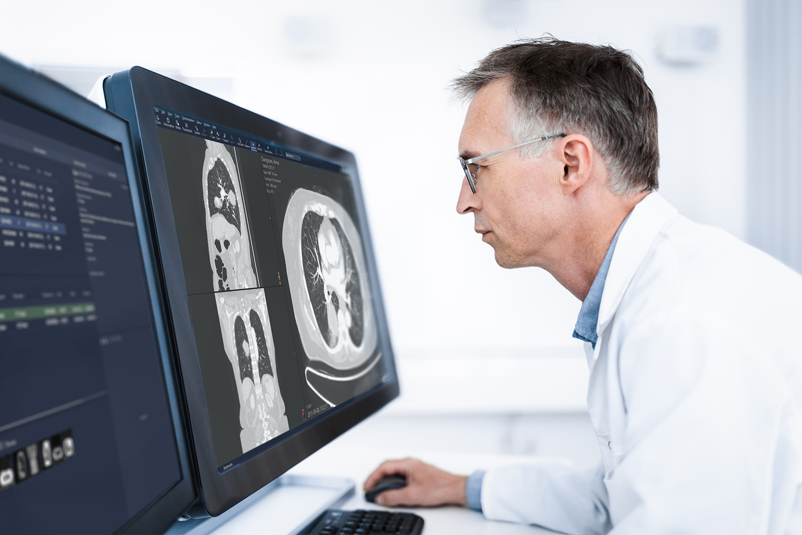 Male radiologist looking at CT scans in Sectra PACS.