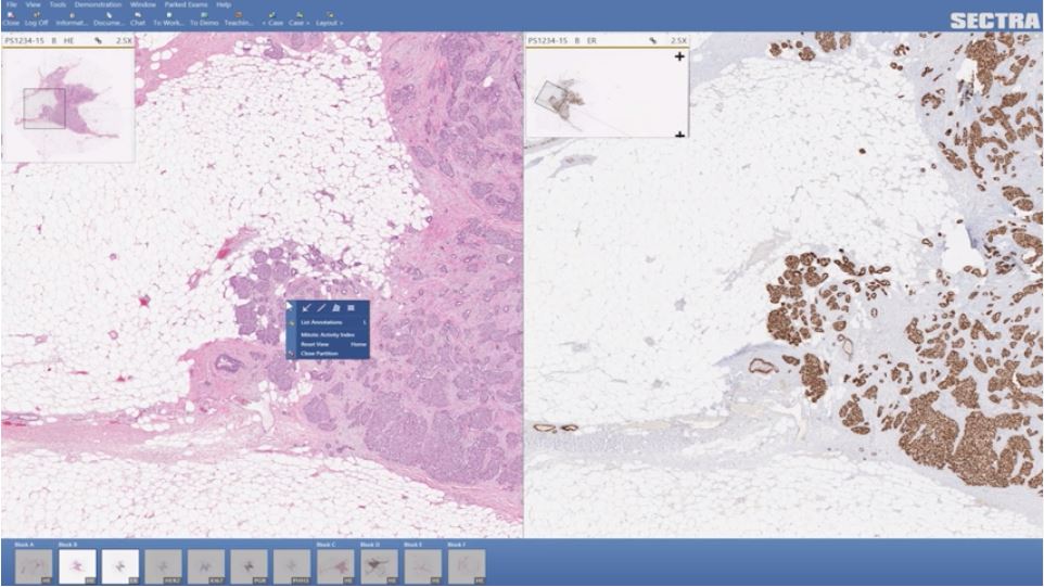 Sectra Digital Pathology PACS | Sectra Medical