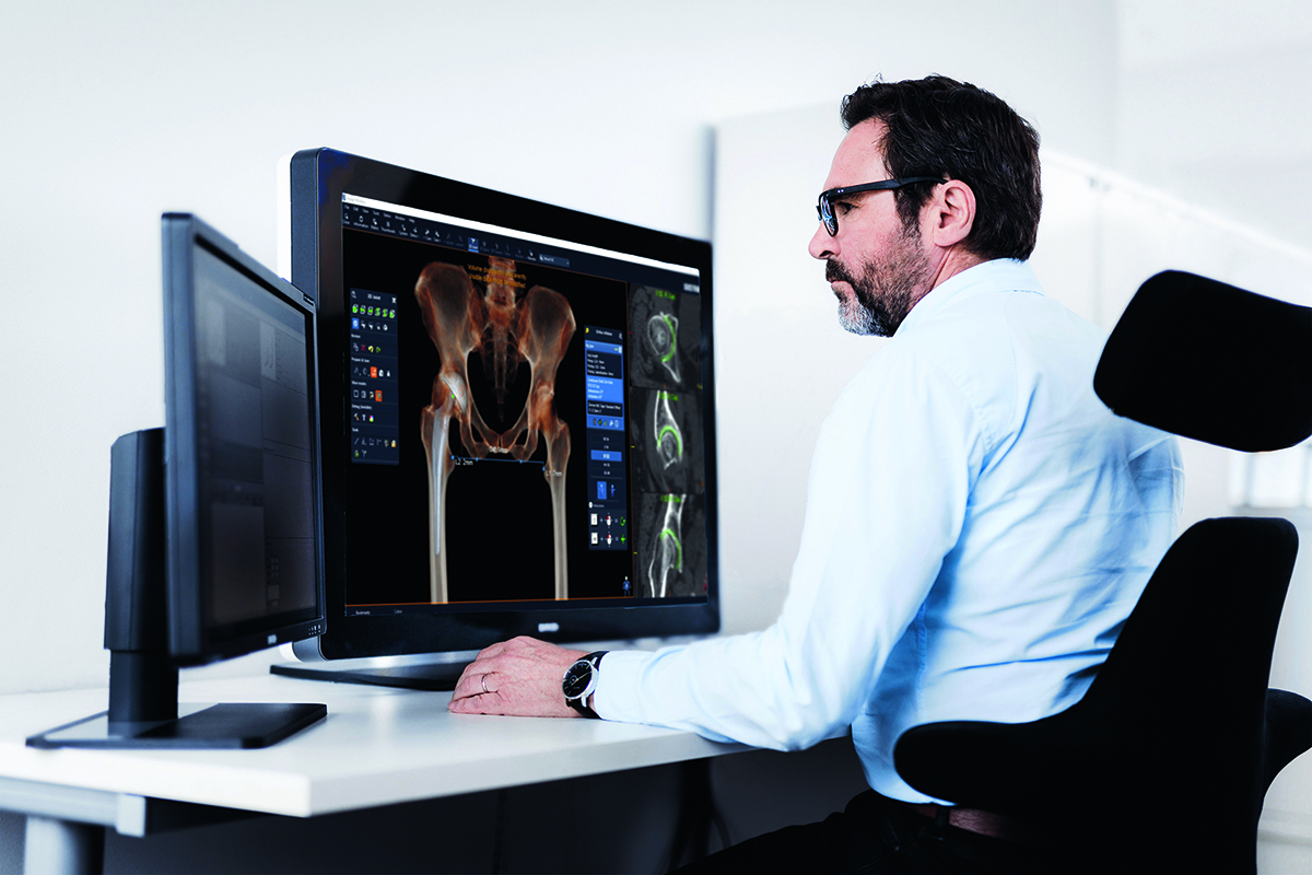 Male surgeoun sitting at a pre-op planning workstation using 3D planning for a joint replacement (ortho)