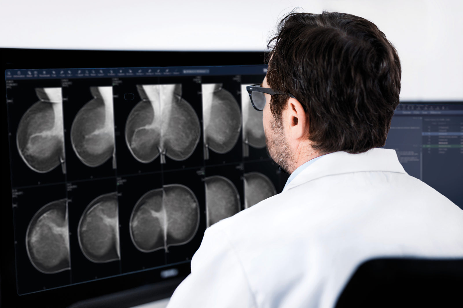 Close-up of male radiologist looking at mammograms in Sectra Breast Imaging PACS.