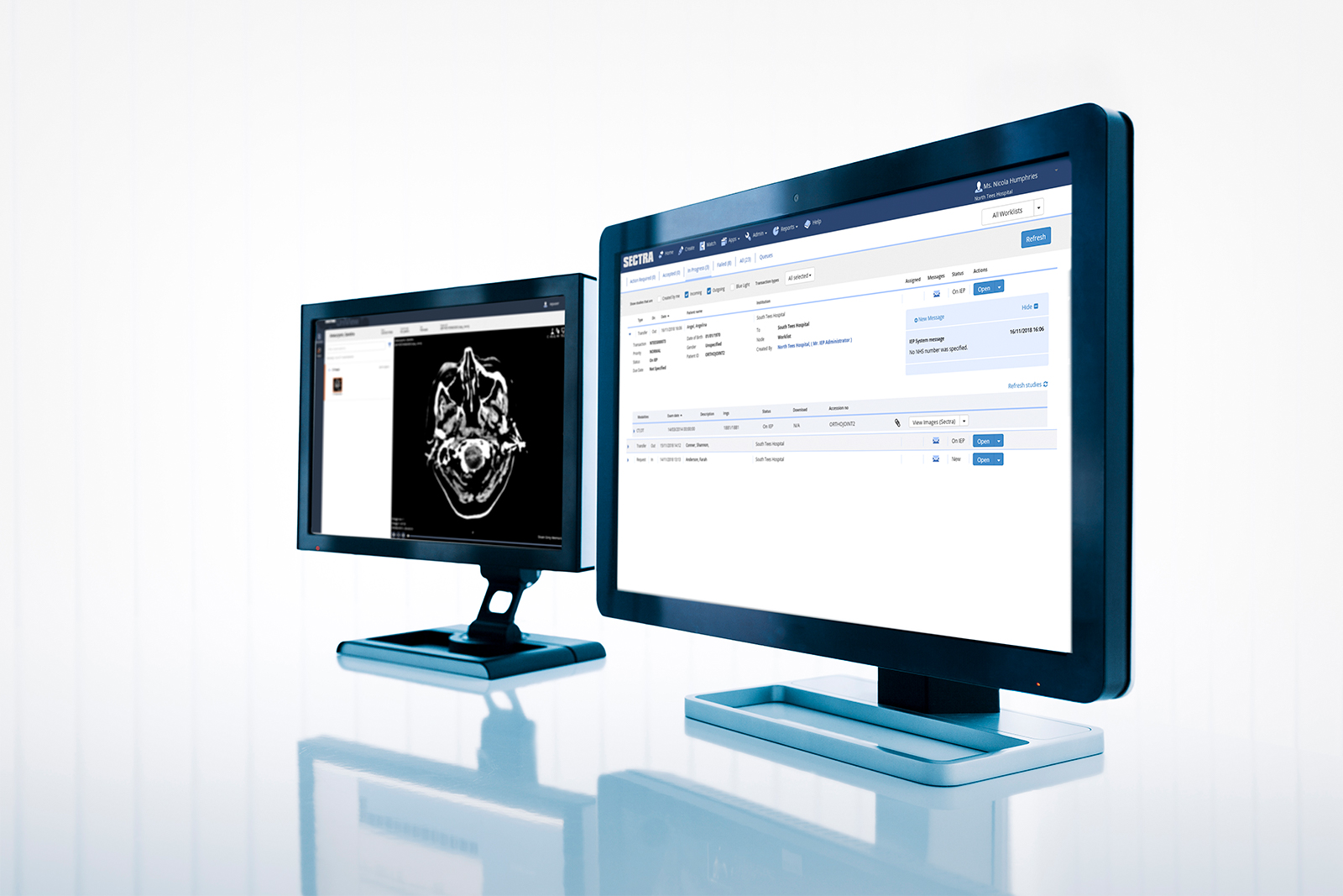 Sectra Image Exchange Portal (IEP) UI in monitors.