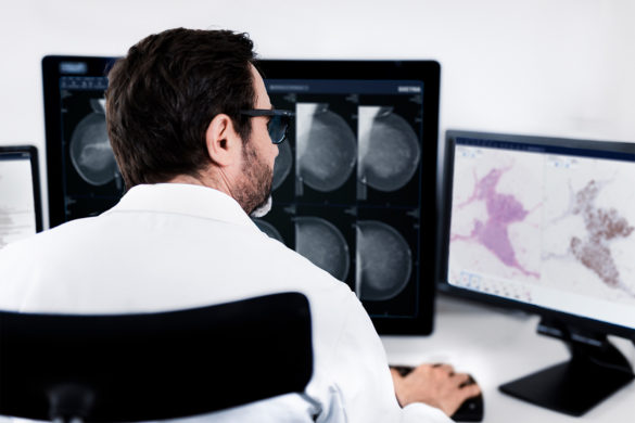 Male radiologist reading breast imaging case in one monitor, and looking at digital pathology images in another monitor.