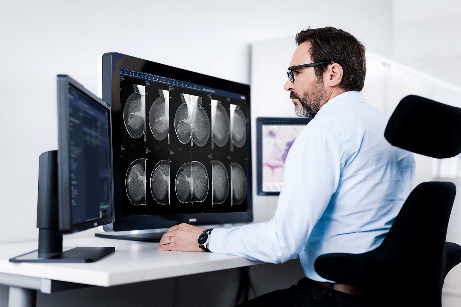 Male radiologist looking at a breast imaging case on monitor (pathology in background)