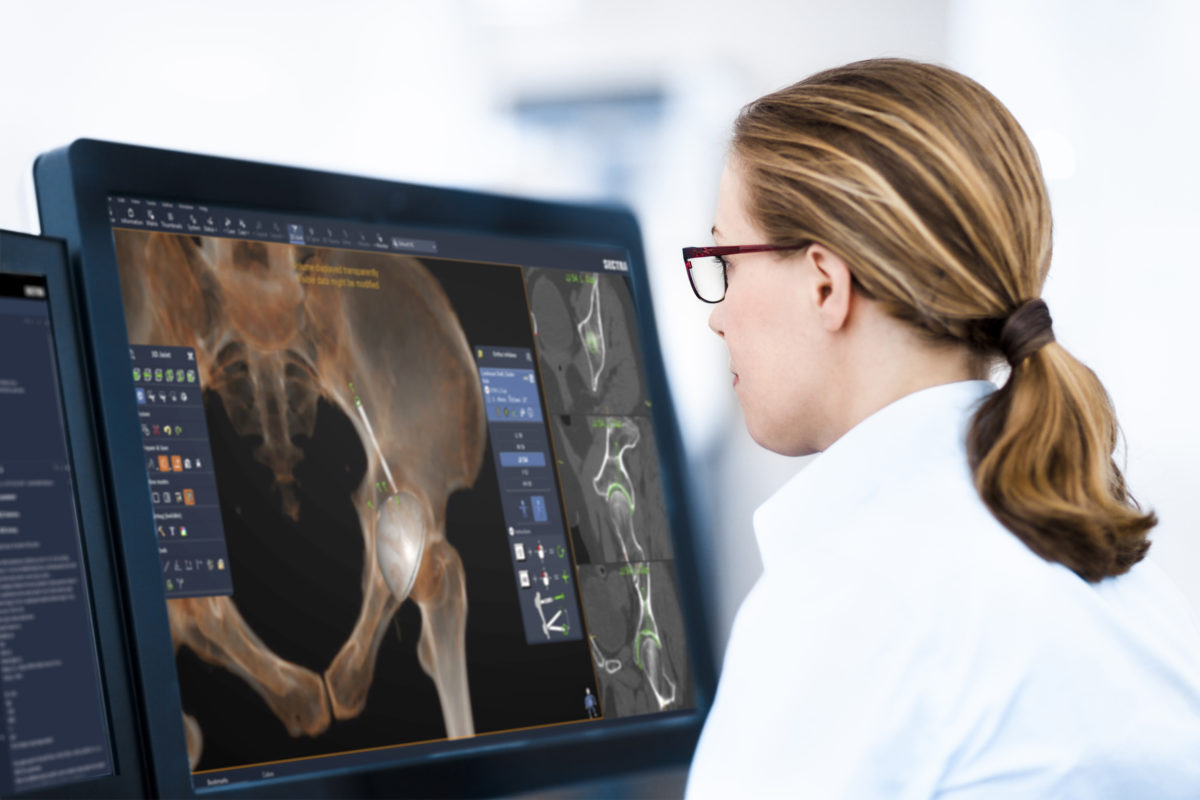 Female surgeoun sitting at a pre-op planning workstation using 3D planning for a hip replacement (ortho)