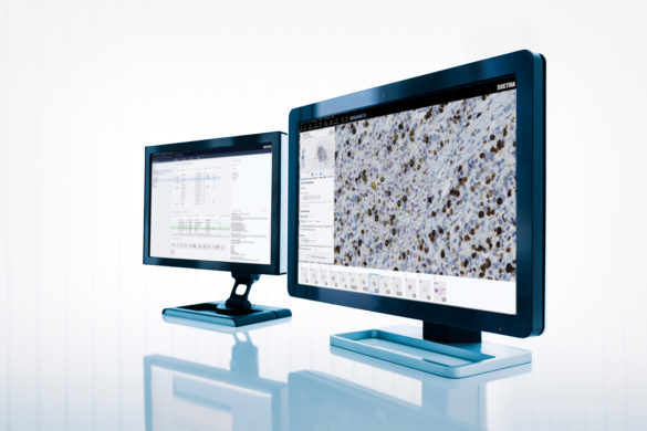 Sectra Digital Pathology Solution | Sectra Medical