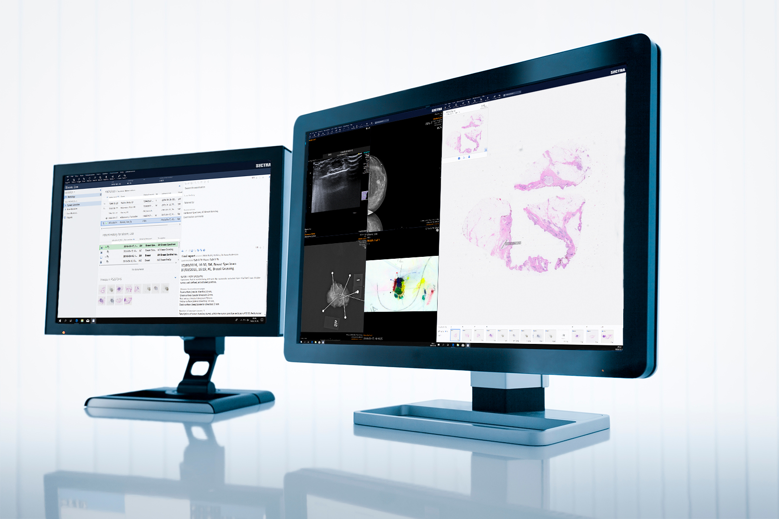 Integrated diganostics - radiology and pathology images side-by-side in monitor