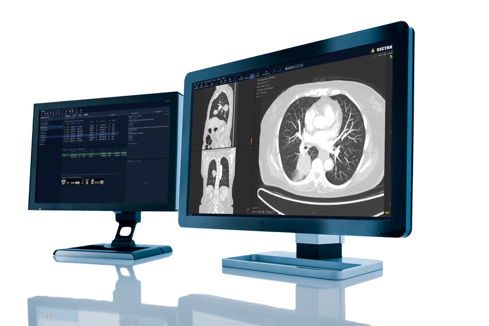 Radiology workstation with Sectra PACS and Sectra RIS