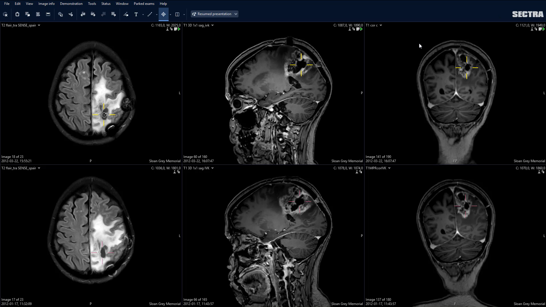 Screenshot from Sectra Anatomical Linking application