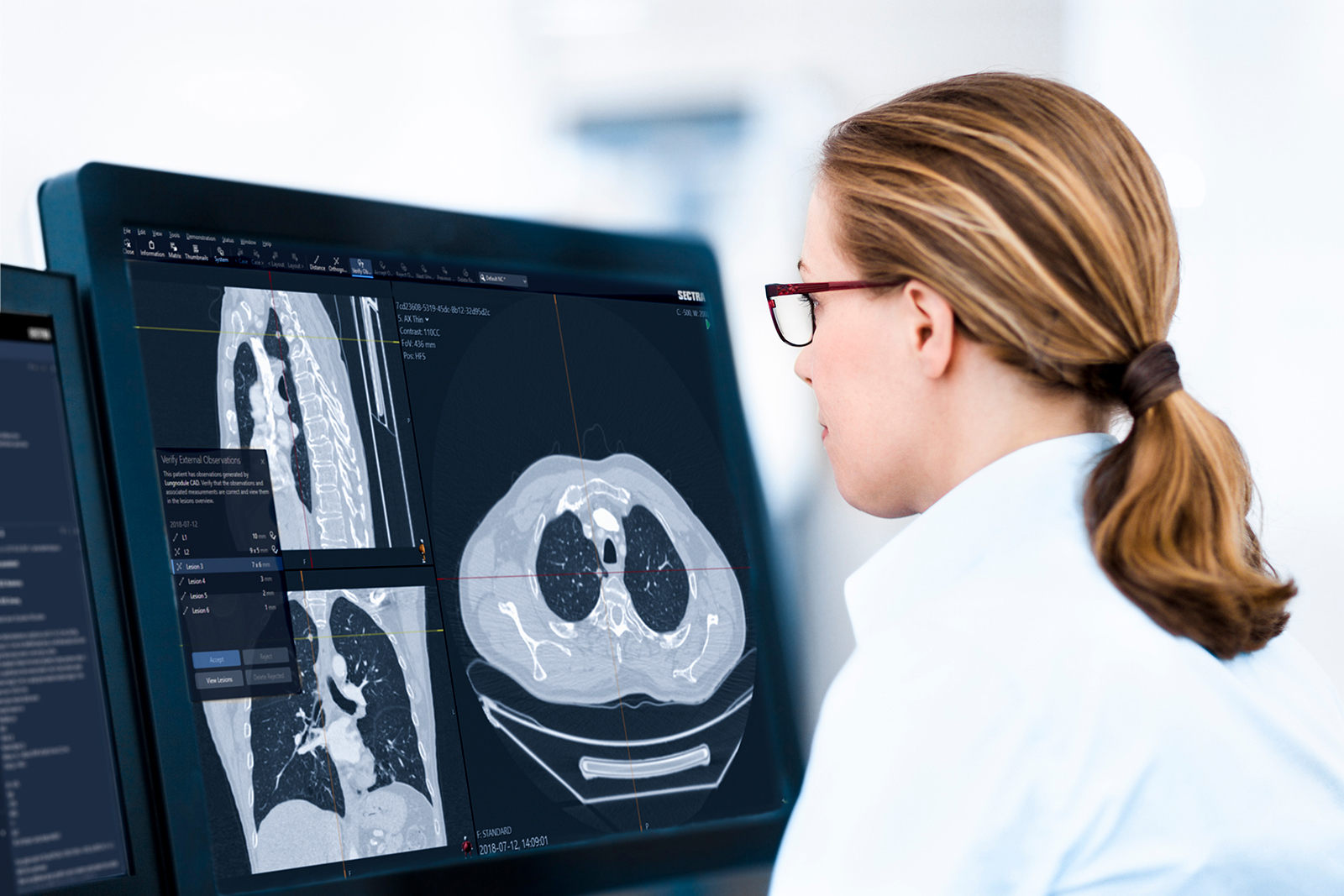 Female radiologist studying a radiology case in front of a monitor