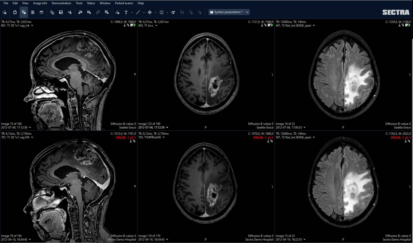 Sectra Anatomical Linking