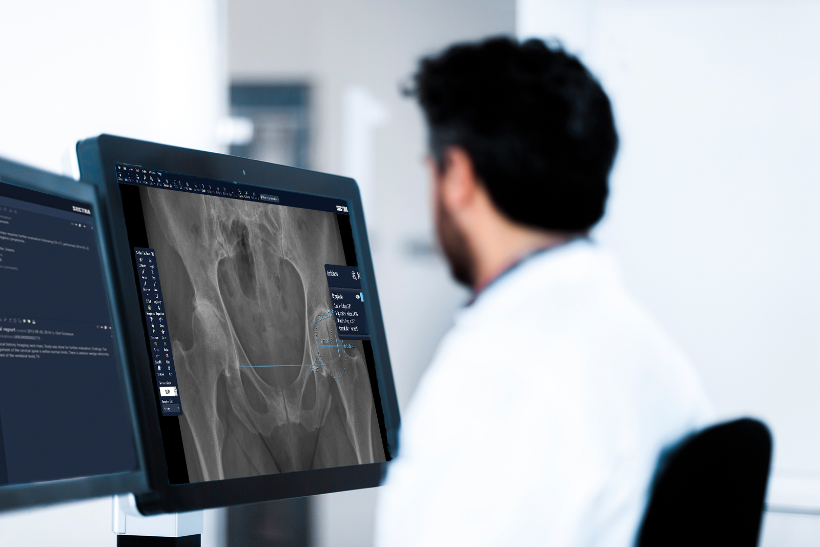 Sectra Dysplasia application