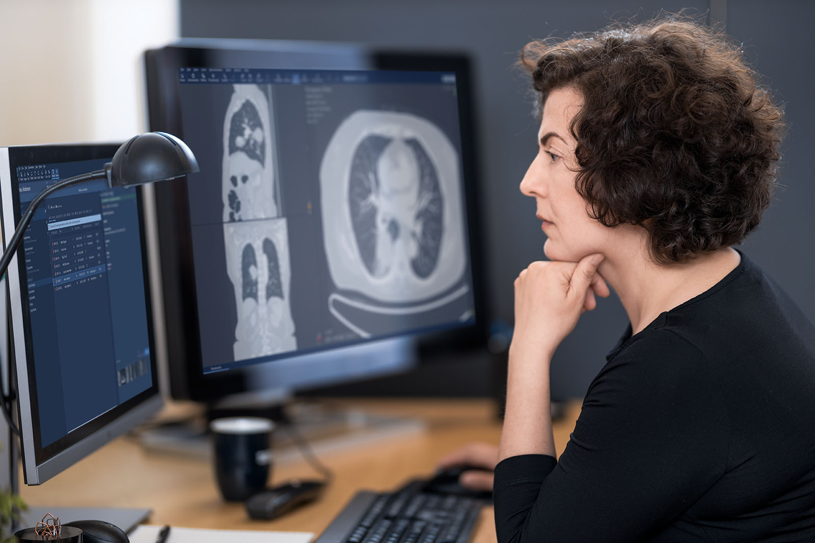 female radiologist sitting in front of a monitor