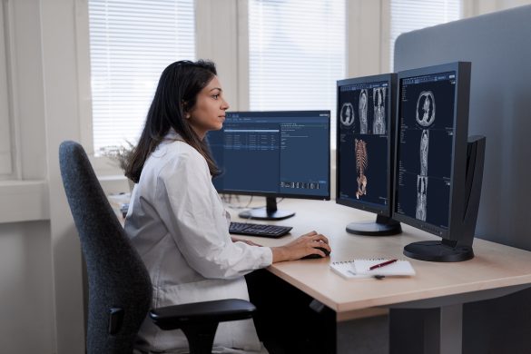 female radiologist sitting in front of a monitor
