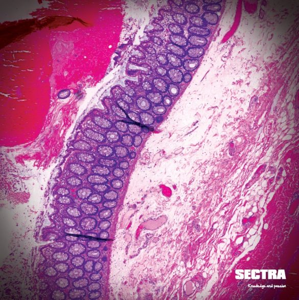 Pink and purple digital pathology scan